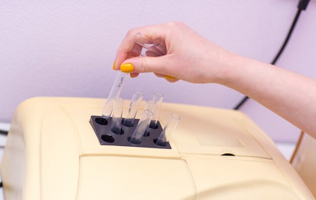 Blood analyzer. Laboratory assistant in medical laboratory holds test tube with blood and plasma in his hand and doing analysis.