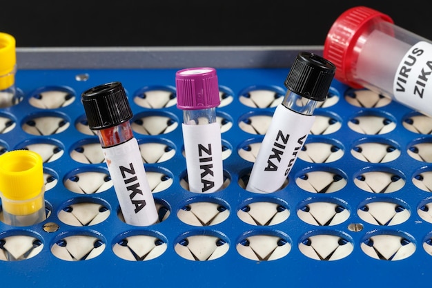 Photo blood collection tubes with labels zika virus