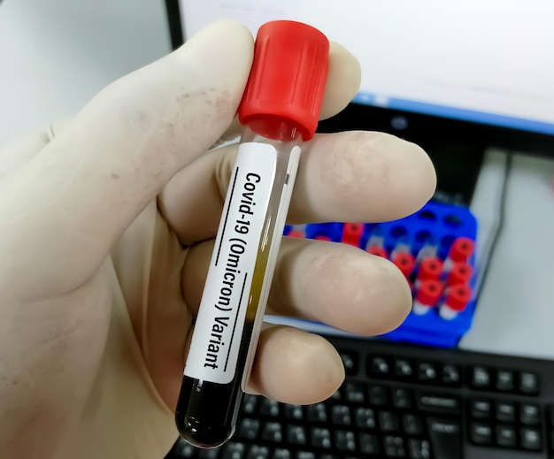 covid 19 또는 코로나바이러스 변이체 테스트에 대한 혈액