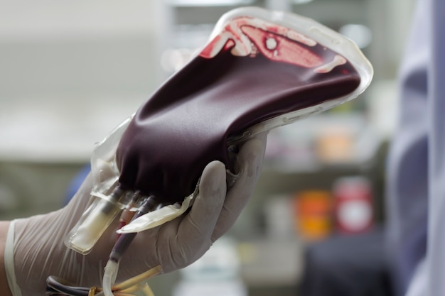 Blood donor in blood bag