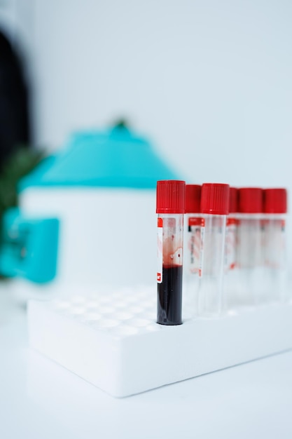 Blood is collected in a medical tube for analysis blood for\
medical research