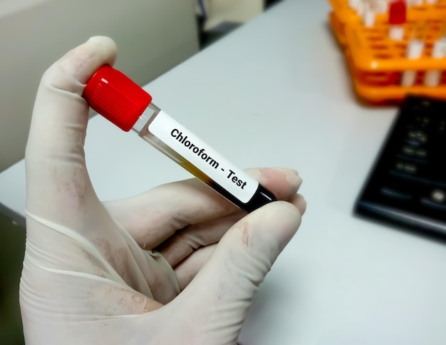 Blood sample for biochemical testing