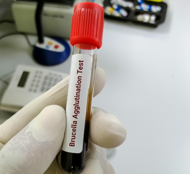 브루셀라 응집 검사를 위한 혈액 샘플