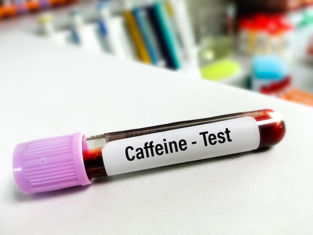 Photo blood sample for caffeine blood test drug therapy medical testing concept