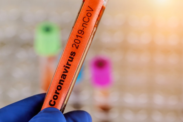 Blood sample for Coronavirus test