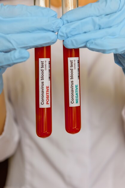 Blood sample of coronavirus