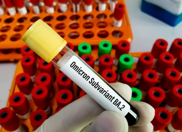 Blood sample for Covid19 Omicron Subvariant or BA2 test at medical laboratory