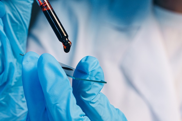 Blood sample drops on test glass close up