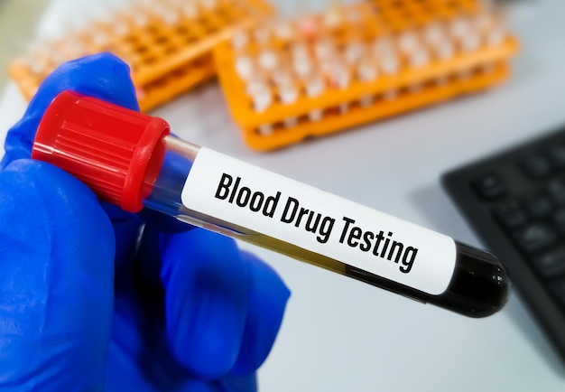 Blood sample for drug testing for athletes