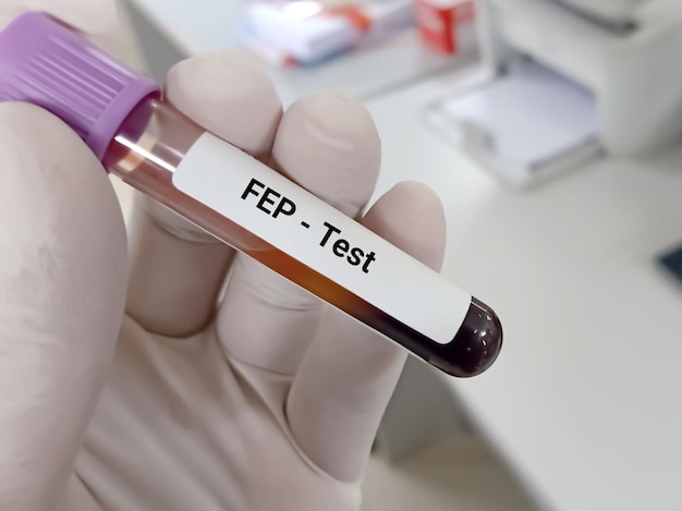 Photo blood sample for fep or free erythrocyte protoporphyrin test diagnosis of anemia disease