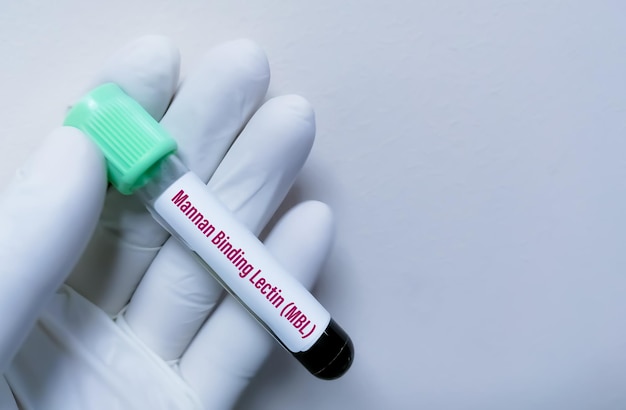 写真 マンノース結合レクチンまたはマンナン結合レクチン検査用の血液サンプル。