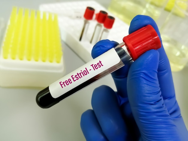 Blood sample for Free Estriol test in laboratory