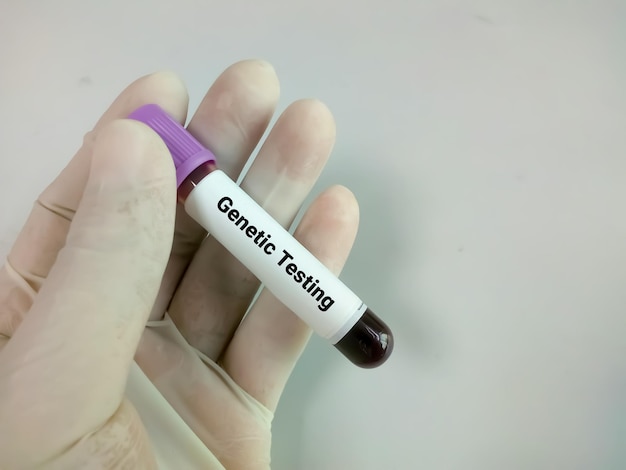 Blood sample for genetic testing or PCR DNA test for genome test