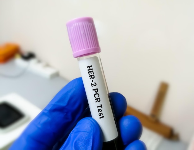Blood sample for Her2 or human epidermal growth factor receptor 2 PCR testing for breast cancer