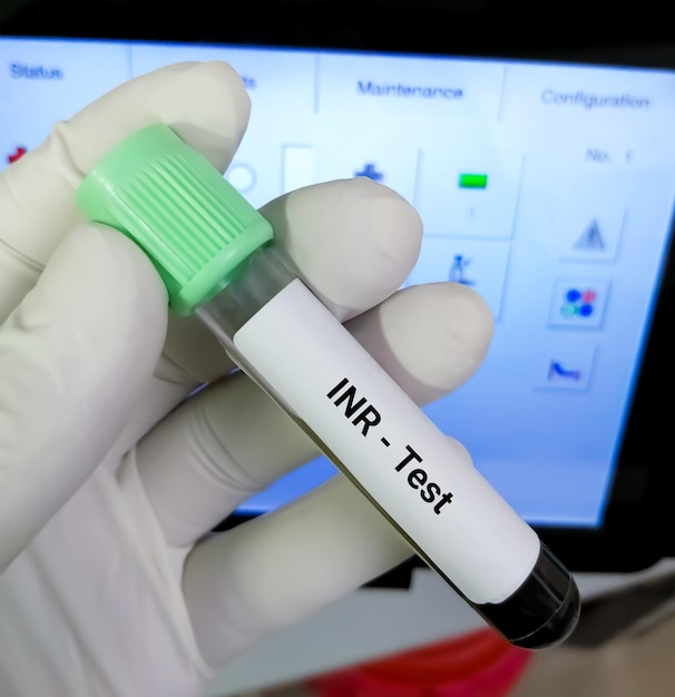 Blood sample for inr or international normalized ratio coagulation testing