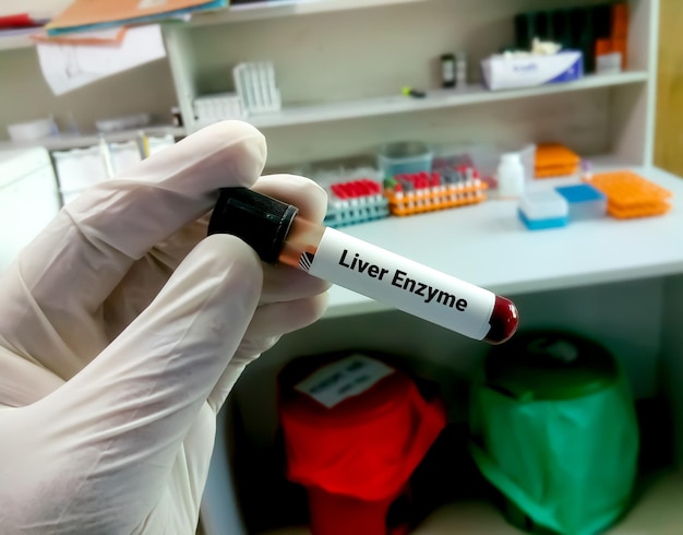 Blood sample for Liver Enzyme test