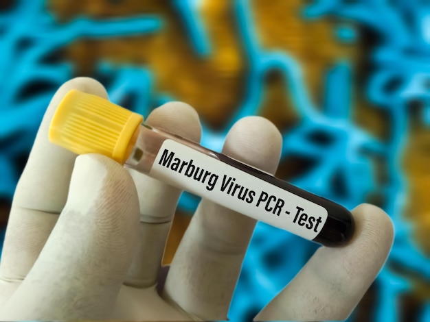 Foto campione di sangue per il test pcr del virus marburg. il virus marburg (marv) sfoca lo sfondo