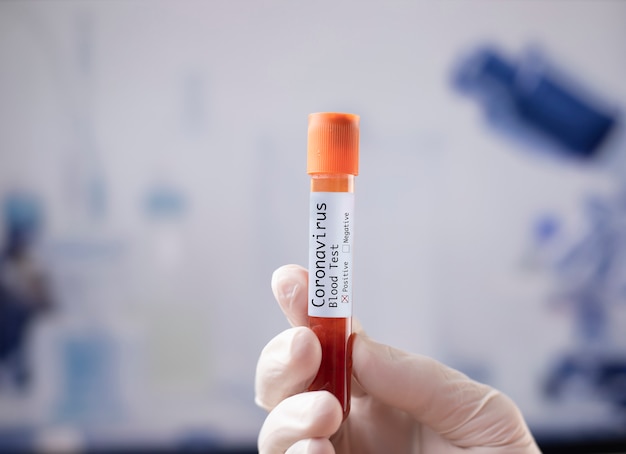 blood sample in medical sample tube