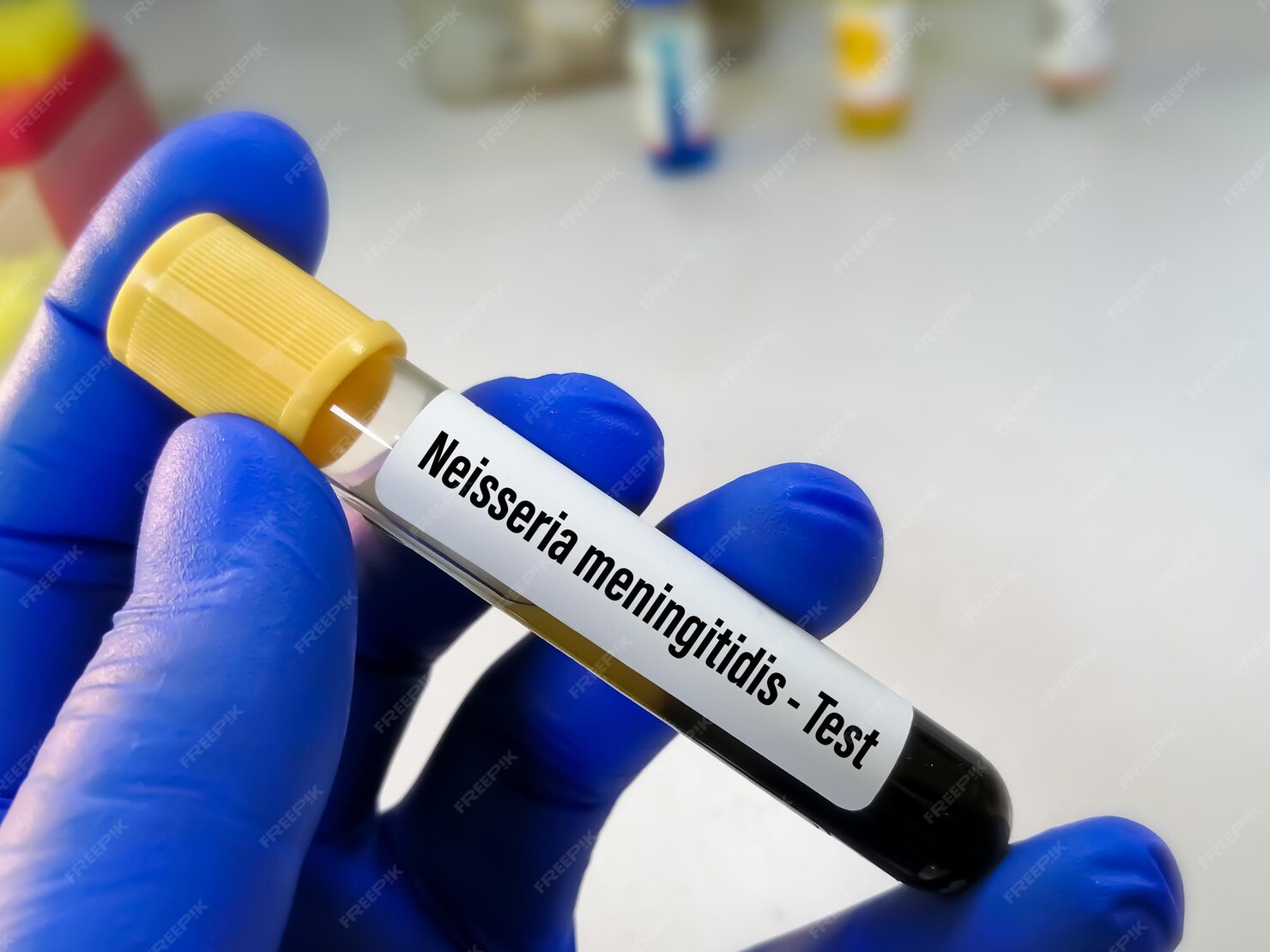 Premium Photo | Blood sample for neisseria meningitidis test, to ...