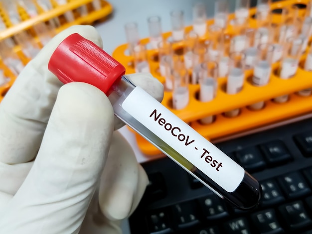 Образец крови для тестирования варианта Neocov