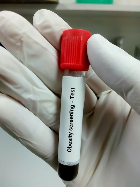 Blood sample for obesity screening test