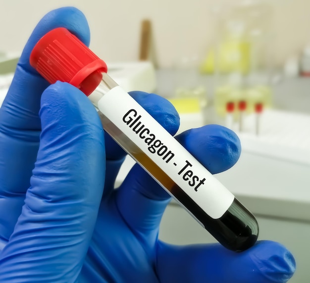 Premium Photo Blood Sample For Pancreatic Hormone Glucagon Test premium-photo-blood-sample-for-pancreatic-hormone-glucagon-test