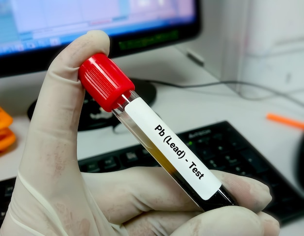 Photo blood sample for pb or lead test blood toxicity testing