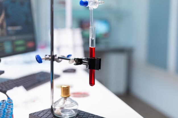 미생물학 실험 중 생물학적 검사를 위해 준비된 혈액 샘플