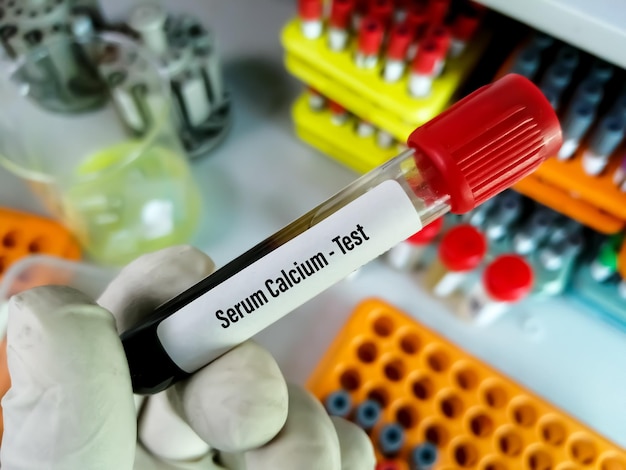 Photo blood sample for serum calcium test