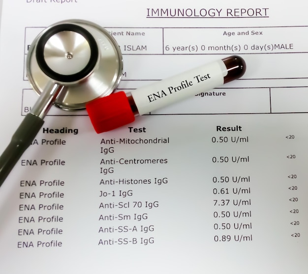 Blood sample and stethoscope isolated on ENA profile test report