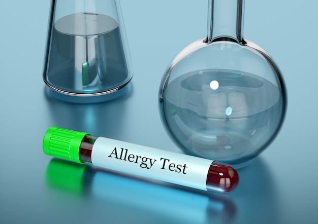 Photo blood sample in test tube for allergy test in laboratory