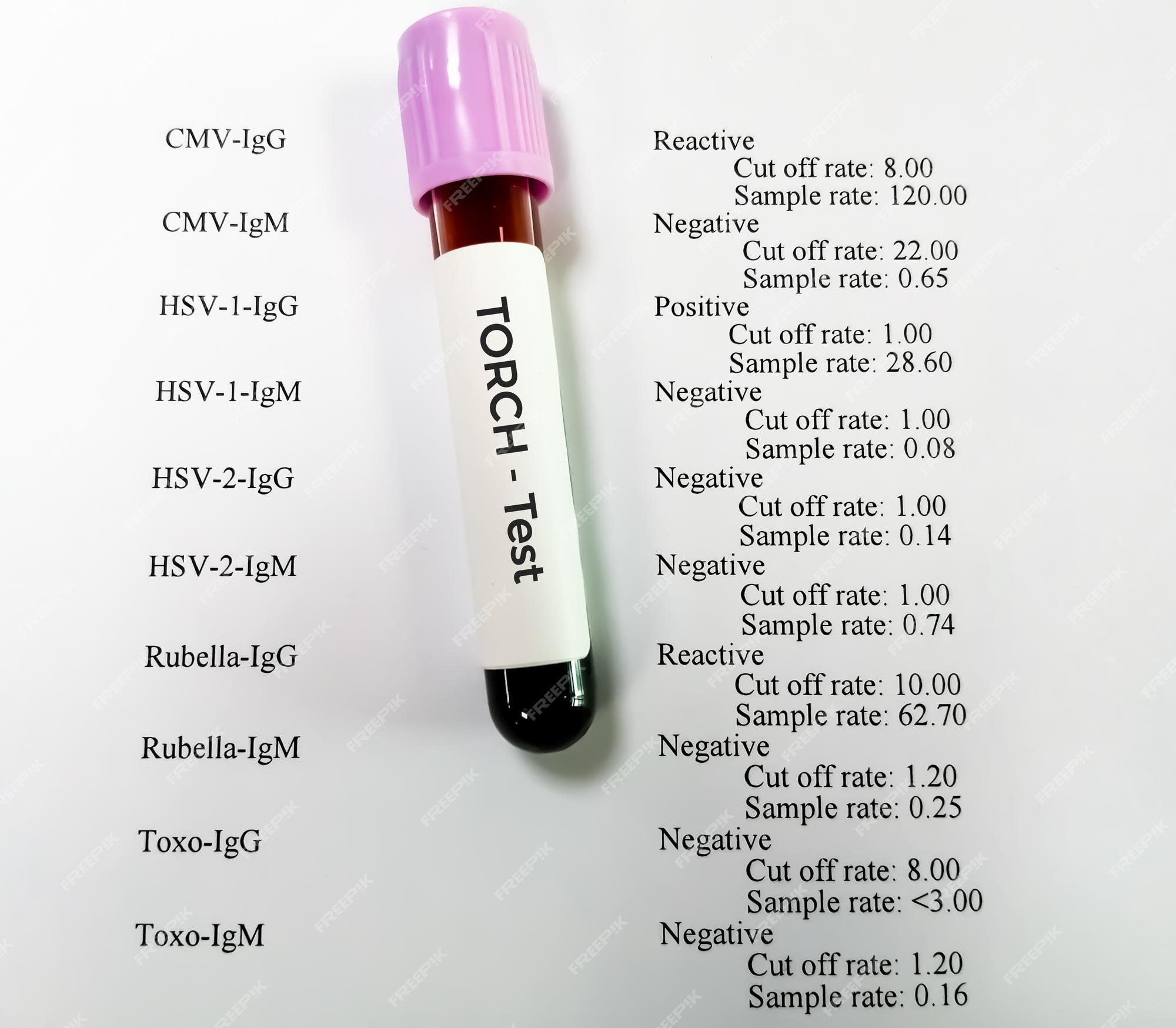 Premium Photo | Blood sample for torch test or torch panel test including  toxoplasma rubella cmv hsv with report