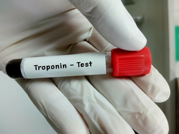 Blood sample for Troponin test diagnosis for cardiovascular disease or myocardial infection