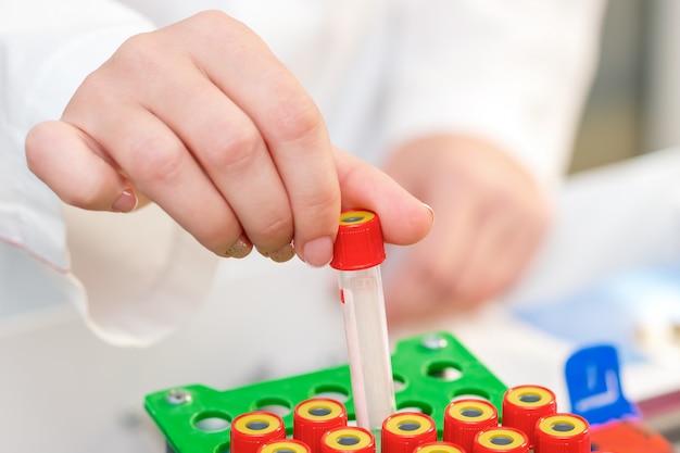 Blood sample tubes in hands