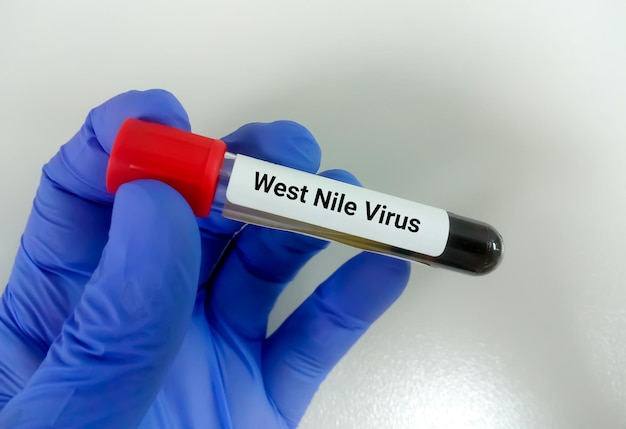 Foto campione di sangue per il test del virus del nilo occidentale