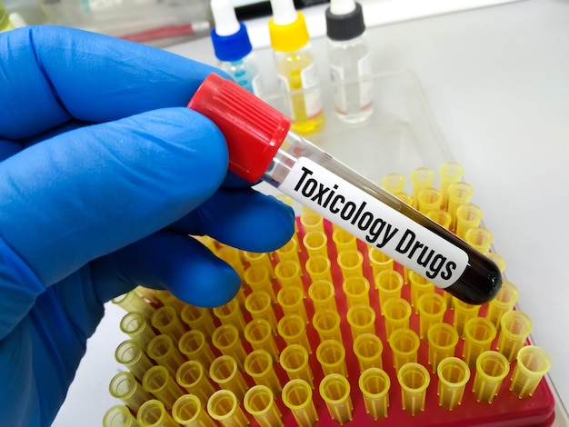 Blood sample with laboratory background for Toxicology drug testing.