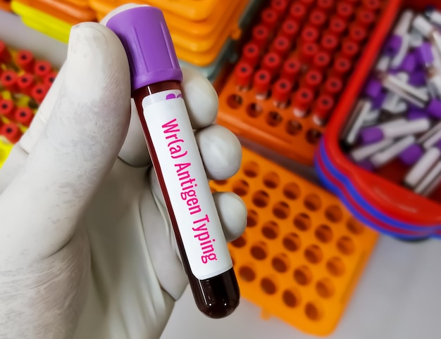 Blood sample for wr(a) antigen test.