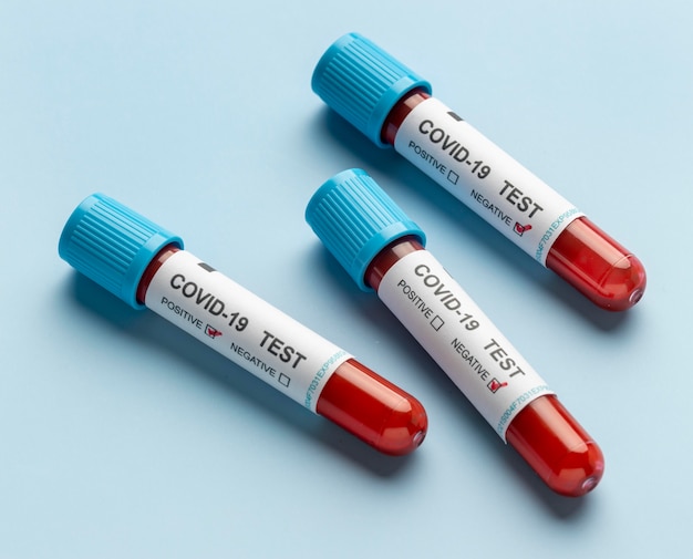 Campioni di sangue per test covid in laboratorio
