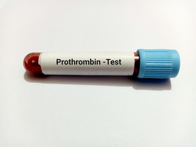 Photo blood samples for prothrombin time pt blood coagulation testing medical or health concept