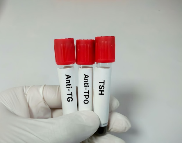 Blood samples for thyroid function testing