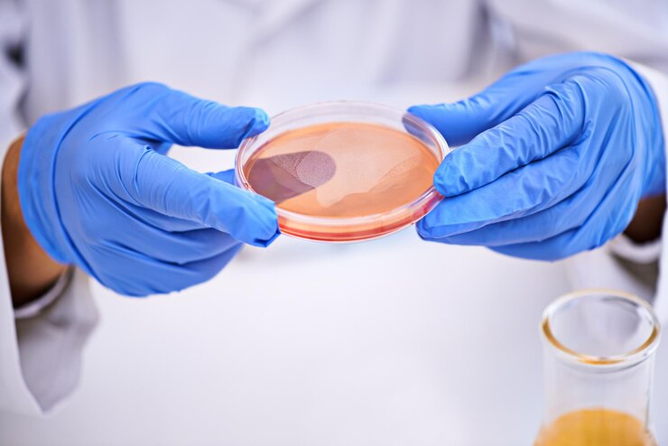 Photo blood science hands and petri dish in laboratory for research studying and monkeypox virus infection disease and medical person test sample and pathology biologist or immunity in dna innovation
