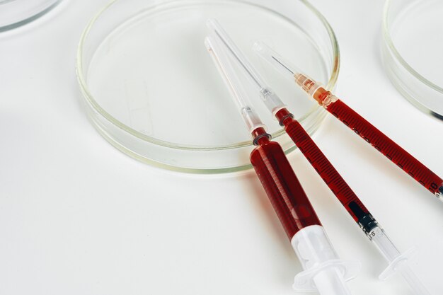 Photo blood test analysis with petri dish close up