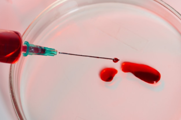 Blood test analysis with Petri dish 