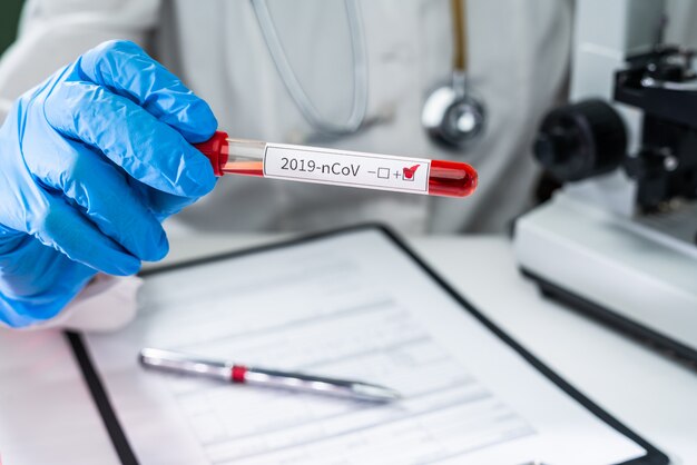 Provetta per analisi del sangue in mano del medico, test del coronavirus mers-cov etichetta positiva in provetta per analisi del sangue in ospedale per analisi. infezione del virus 2019-ncov originaria di wuhan, cina