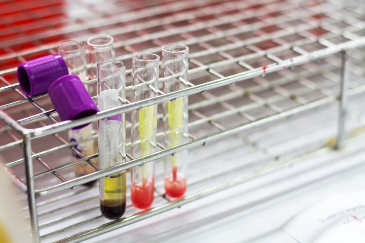 Photo blood in the test tube for use as a test sample.