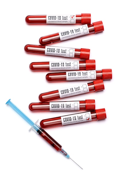 Blood test tube with red plug isolated on white background.