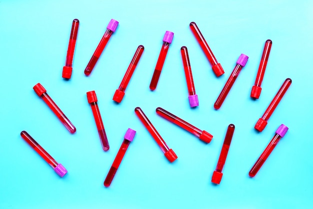 Blood in test tubes on blue background.