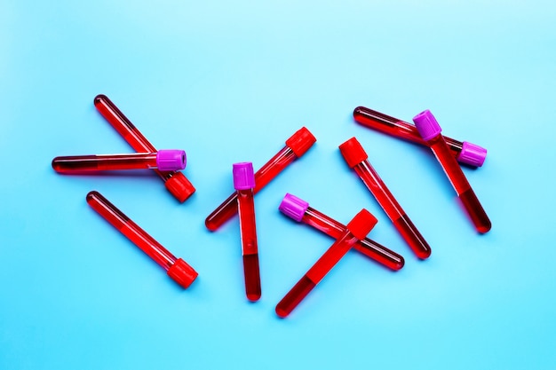 Blood in test tubes on blue background.