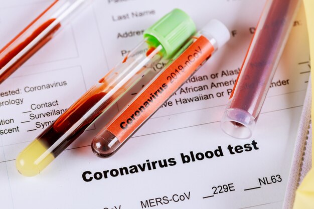 Blood test tubes at the laboratory