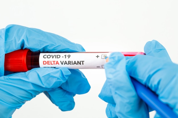 Esame del sangue con l'etichetta covid-19 delta variant.